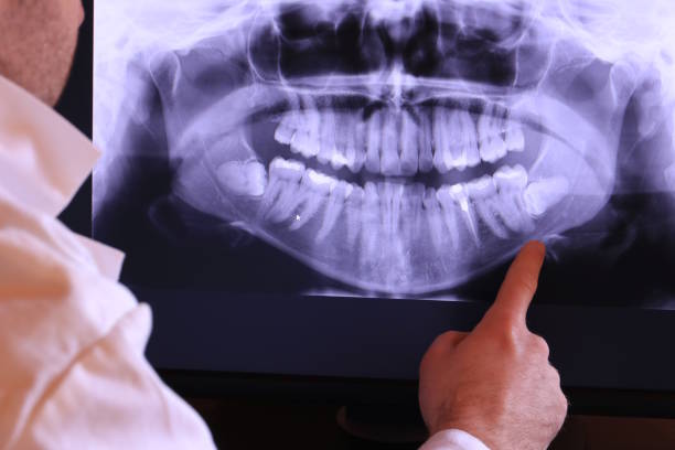 Best After-Hours Dental Trauma Care in Robins Af, GA