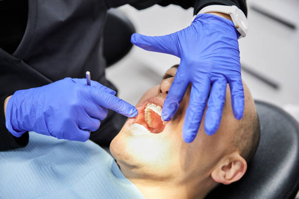 Best Emergency Root Canal Treatment in Robins Af, GA